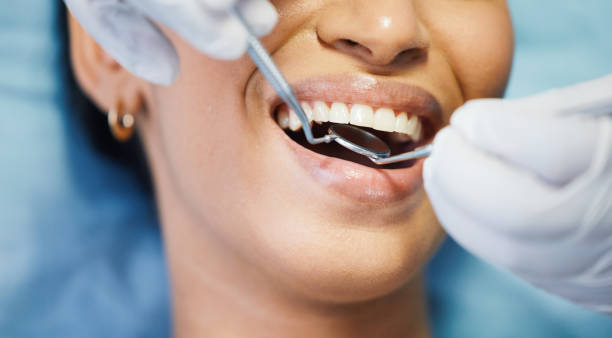 Best Weekend Emergency Dentist in Shingletown, CA