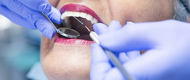 Best Emergency Dentist for Knocked-Out Tooth in Shingletown, CA